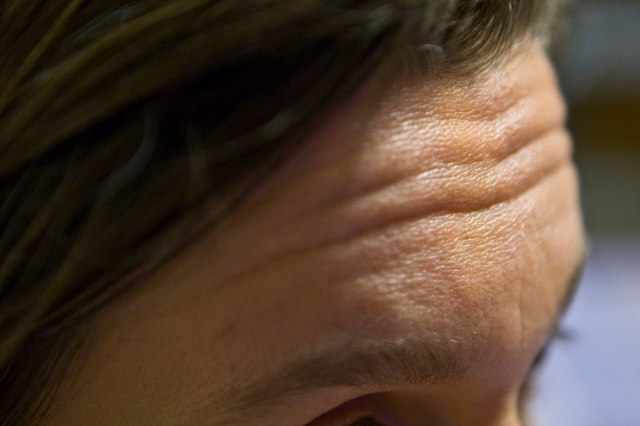 Namirnice zbog kojih imamo sve više bora i prerano starimo